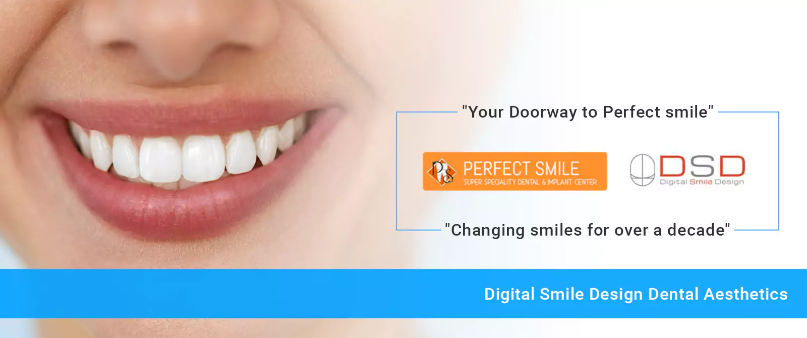 Best Dentist in Bangalore