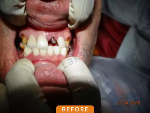 dental