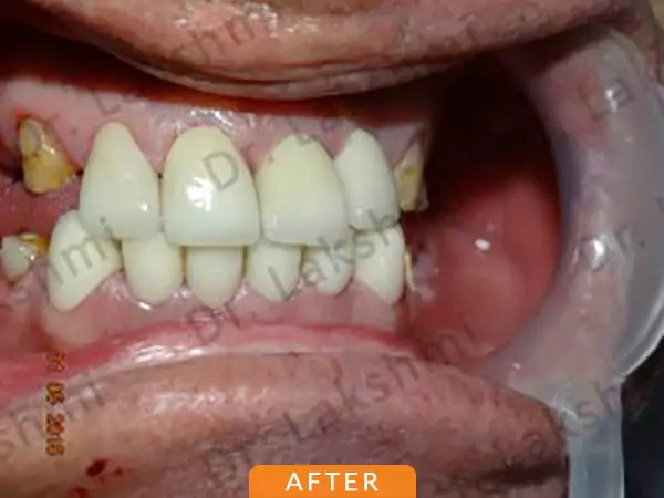 dental