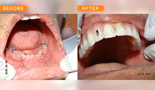 dental