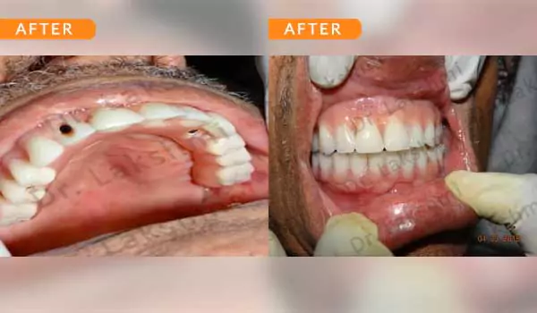 dental