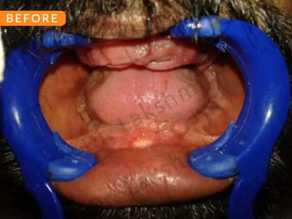 dental
