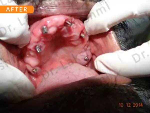 dental