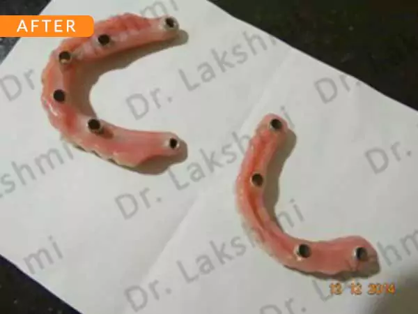 dental