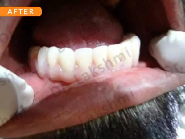 dental