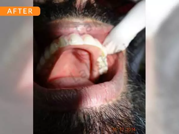 dental