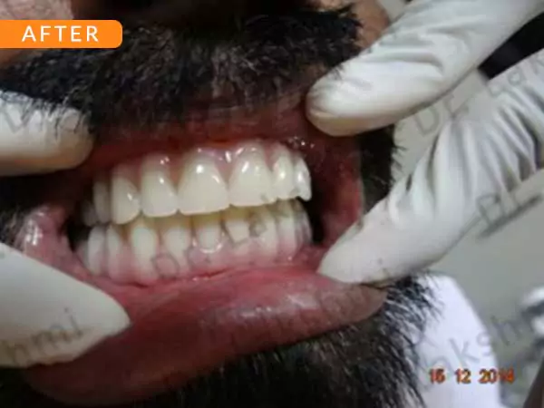 dental