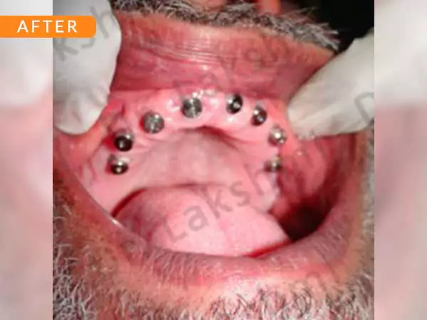 dental