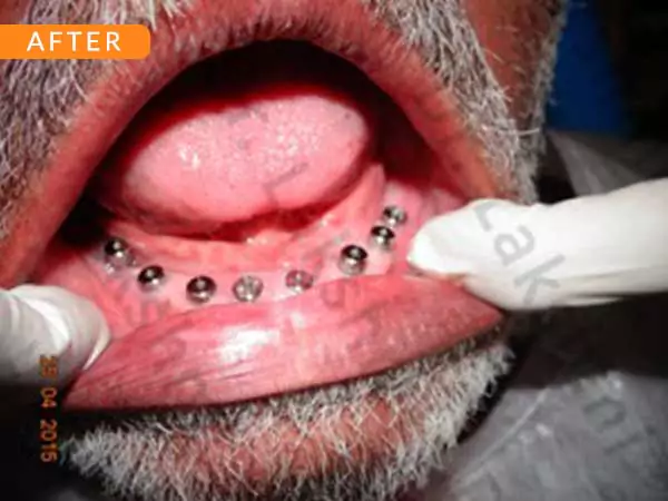 dental