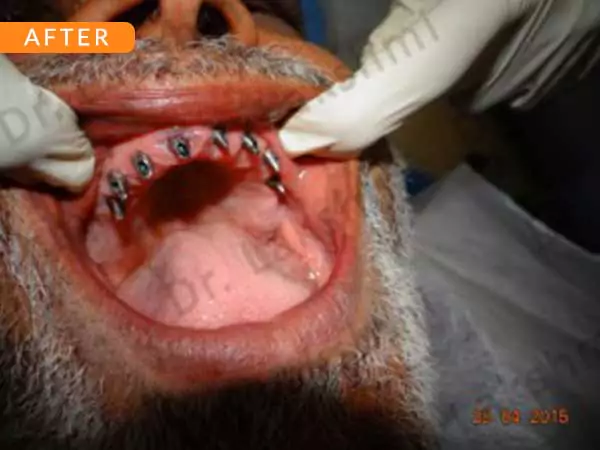 dental