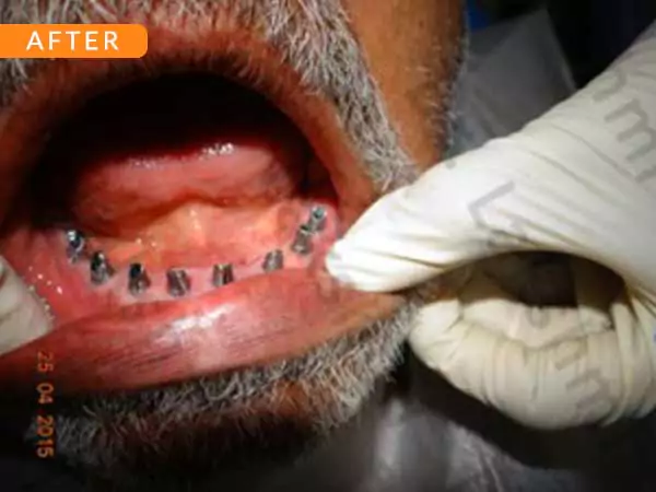 dental