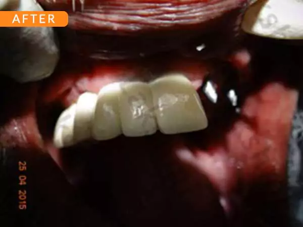 dental