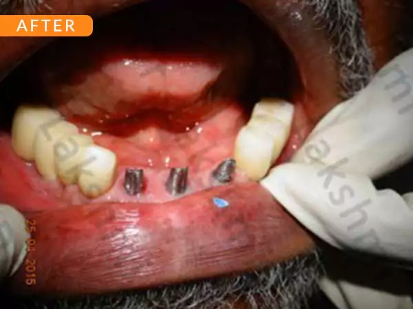 dental