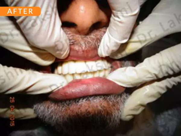 dental