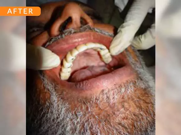 dental
