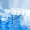 dental solutions