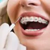 dental solutions