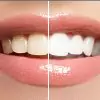 dental solutions