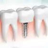 dental solutions