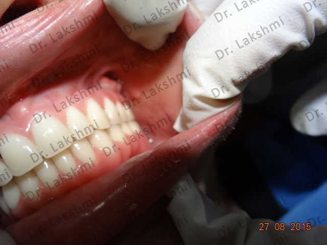 imageuploads/covered/2018/07/06/imageuploadscovered20180706imageuploadscovered20180706imageuploadscovered20180706pagejpgjpgjpg.jpg