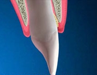 imageuploads/covered/2018/07/07/imageuploadscovered20180707imageuploadscovered20180707periodontalhtmljpgjpg.jpg