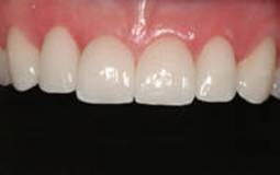 scale_your_smile.html