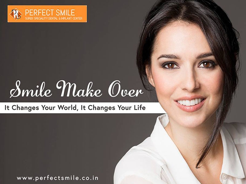 smile makeover 