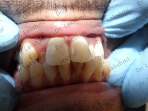 TAILOR-MADE TREATMENT PLANS