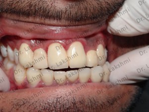 TAILOR-MADE TREATMENT PLANS 