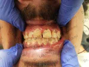 TAILOR-MADE TREATMENT PLANS