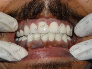 TAILOR-MADE TREATMENT PLANS 