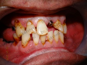 TAILOR-MADE TREATMENT PLANS