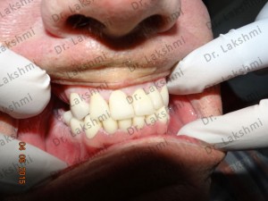 TAILOR-MADE TREATMENT PLANS